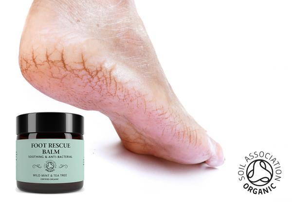 get the best natural balm for cracked heels itchy feet and foot pain